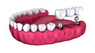 dentista est Europa ? Croazia, Romania, Serbia oppure Albania ?