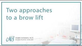 Two approaches to a brow lift