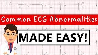 Common ECG abnormalities | MADE EASY!