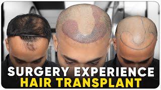 Hair Transplant in Mysore | Best Results & Cost of Hair Transplant in Mysore