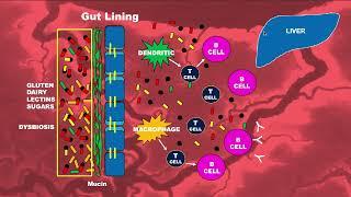 VDR Renewal through Anti-inflammatory Diet Explained by Dr. Eduardo Beltran