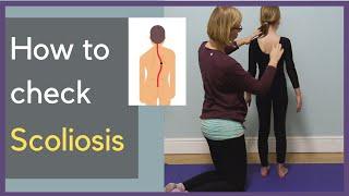 Easy way to check your child for scoliosis