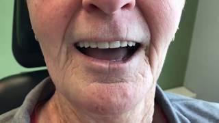 Testimonial Video - Woodside Denture Centre