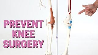 The 3 Things You Should Try BEFORE Knee Surgery or Replacement + Giveaway