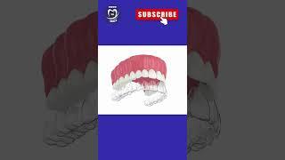 INVISIBLE ALIGNERS #dentist #shorts #short #shortvideo #shortsvideo #dentistry #viral #video #dental