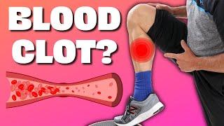 Is Your Calf Pain a Blood Clot!? Do Homan's Test and Find Out.