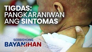 Gaano kabilis makahawa ang tigdas o ilang araw bago lumabas ang sintomas?