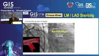 61  Ahmed Kasem   Case 8  The Challenge of LM LAD Cross over Stenting during Primary PCI