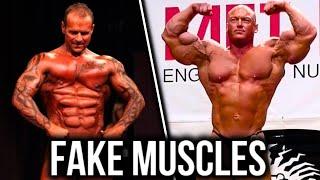 The WORST Implants In Bodybuilding!