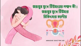 জরায়ুর মুখে টিউমার চিকিৎসায় করণীয় । Amader Doctor BD