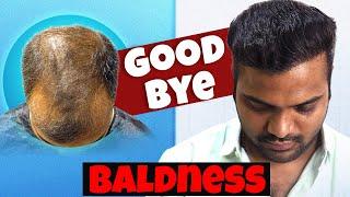 Say Goodbye to Baldness: Hair Transplant in Vashi | New Roots Hair Clinic