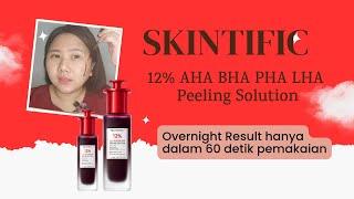 SKINTIFIC PEELING SOLUTION ( FULL REVIEW )