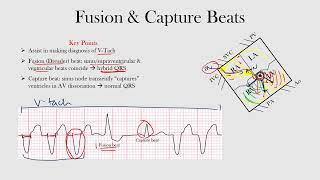 fusion & capture beats