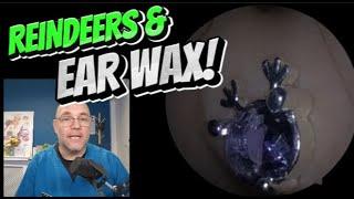 REINDEERS & EAR WAX! 389 #ear #earwax #earwaxremoval #asmr #satisfying #foryou #fyp #foryourpage