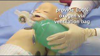 Endotracheal Tube Suctioning by M.J. Manning | OPENPediatrics