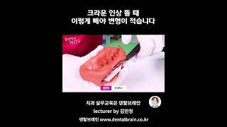 크라운 인상 뜰 때 이렇게 빼야 변형이 적습니다 #치과위생사  #치위생사 #치과