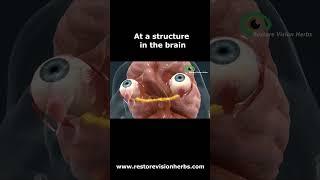 Overview of Optic Nerve Disorders  - The Retina and Optic Nerve