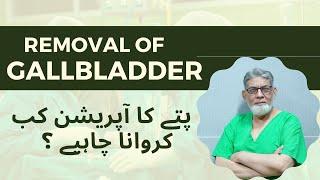 Gall Bladder Surgery: When to have? | Urdu | | Prof Dr Javed Iqbal |