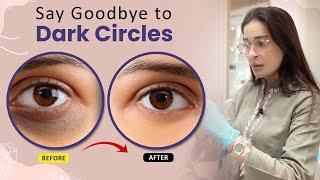 Dr  Shaista Lodhi Reveals the Shocking Truth About Dark Circles! #DarkCircles