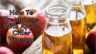 How To Treat Acne With Apple Cider Vinegar | Natural Health Zone