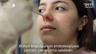 Op.Dr. Elvira Yaqubova - Endoskopik lor müayinə