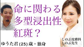 ⑧多型滲出性紅斑　頂いたリクエストにお答えして、多型滲出性紅斑についてお伝えします。これは、命にかかわるガン以外の皮膚の疾患ですよ！皆さんもゆうた君と一緒に皮膚の知識を深めてくださいね。