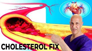 The Most Effective Way to Lower Your Cholesterol Naturally in 7 Days!  Dr. Mandell