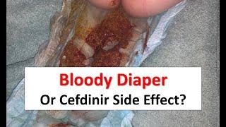 Bloody Diaper or Cefdinir Side Effect?