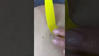 Как убрать запоры? #масаж #массаж #тейпирование #massage