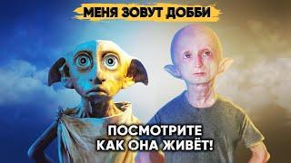 DOBBY IN REAL LIFE. An amazing story of a girl from Siberia.