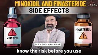 Minoxidil and Finasteride Side Effects | The Truth About Hair Loss Treatment