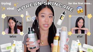 trying *VIRAL* KOREAN SKINCARE for the first time!! did it help my acne? (before and after REVIEW)
