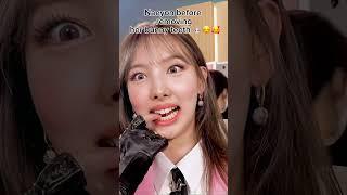 Naeyon before VS after removing her bunny teeth  #twice #bunnyteeth #love