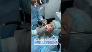 Установка импланта. Implant installation.