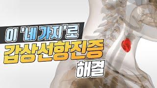 갑상선항진증, 더이상 고민 말고 이렇게 해결해 보세요