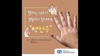 멜라닌 색소가 결핍되어 발생하는 “백반증”