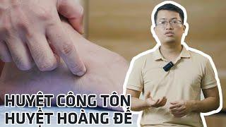 Vì sao huyệt Công tôn còn có tên gọi là huyệt Hoàng đế?