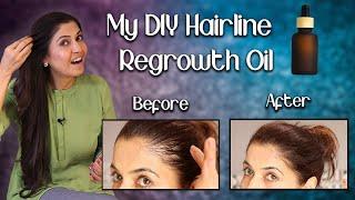 Hairline Regrow Oil For Thick Hair/Rapid Hair-growth Oil - Ghazal Siddique