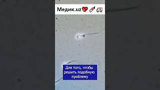 Как сперматозоиды понимают куда им двигаться #сперматозоид #реотаксис