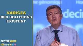 Varices, des solutions existent - Capital santé - Jean-Claude Durousseaud