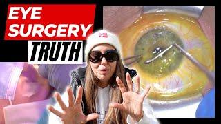 EYE SURGERY & THE BIGGEST REGRET OF MY LIFE: The Most Detailed Video about Eye Surgery with Results