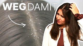 What types of dandruff are there and how do they develop? (+ tips for dandruff)