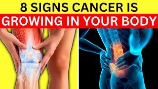 Don't Ignore These 8 Early Cancer Signs - It Could Change Your Health!