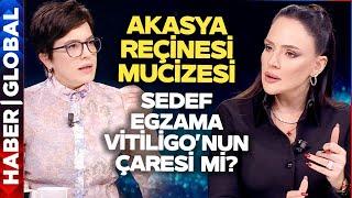 Cilt Hastalıklarının Sebebi Bağırsaklar Mı? Buket Aydın'la Yüz Yüze'nin Konuğu Reyhan Aliusta