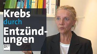 Ärzte klären auf: Oft sind chronische Entzündungen die Ursache von Krebs | BR24