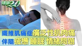 纖維肌痛症 廣泛性肌肉痛 伴隨 疲憊.睡眠.情緒問題 健康2.0@tvbshealth20