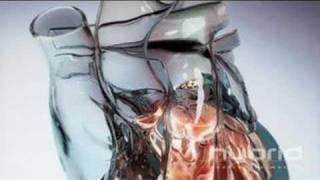 Glass Heart (Hybrid Medical Animation)
