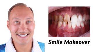 A Radiant Change: Smile Makeover Experience at Sani Dental Group