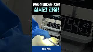 전립선비대증 #리줌 치료과정 #shorts #비뇨기과 #전립샘