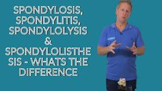 Spondylosis, Spondylitis, Spondylolysis & Spondylolisthesis - Whats the difference?